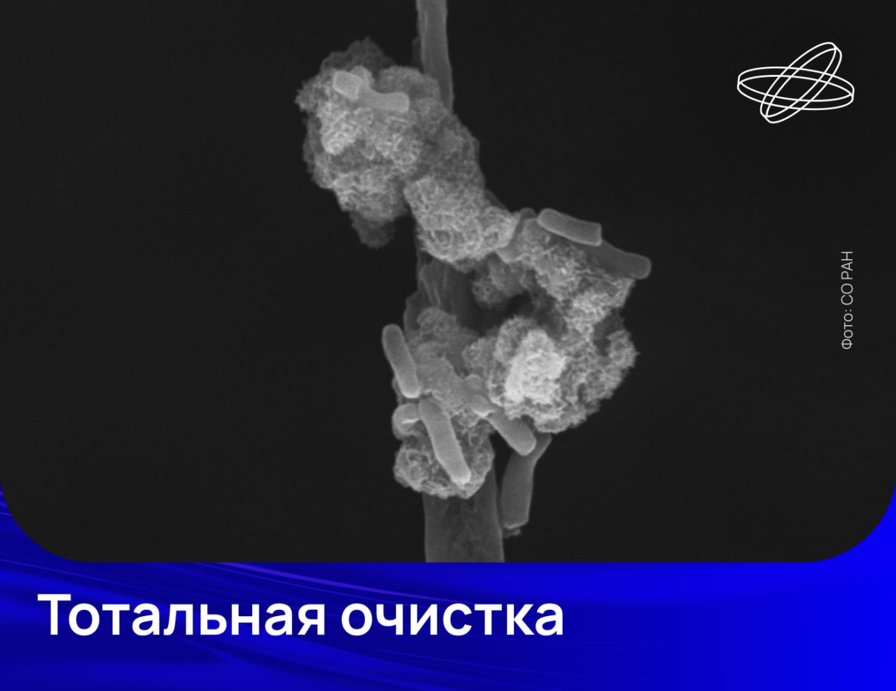 Полностью очистить воду от болезнетворных микроорганизмов может гибридный адсорбент