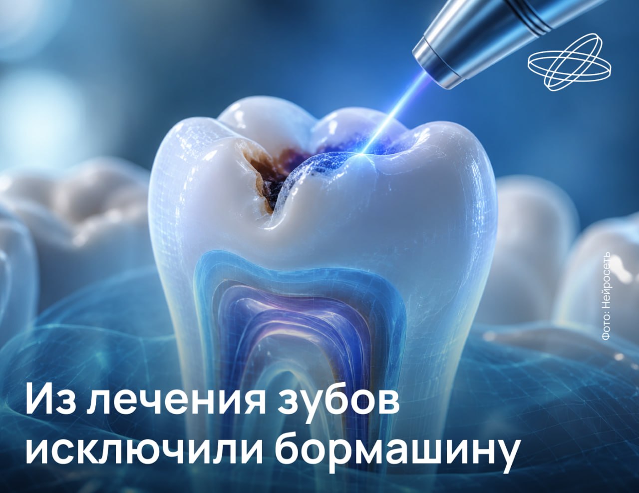 Российские медики разработали методику лечения кариеса без применения бормашины. По результатам испытаний её эффективность составила 90 %.